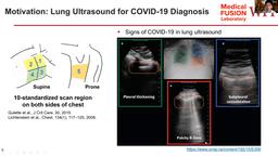 thumnail for COVID-19 Research Lightning Talk - Haichong (Kai) Zhang, Worcester Polytechnic Institute.mp4
