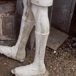 Plaster legs.