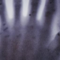 X-ray photograph of lead sh...
